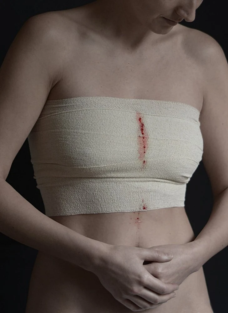 Wounded Torso Healing
