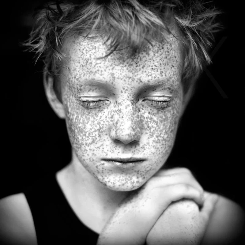 Freckled Child Dreaming