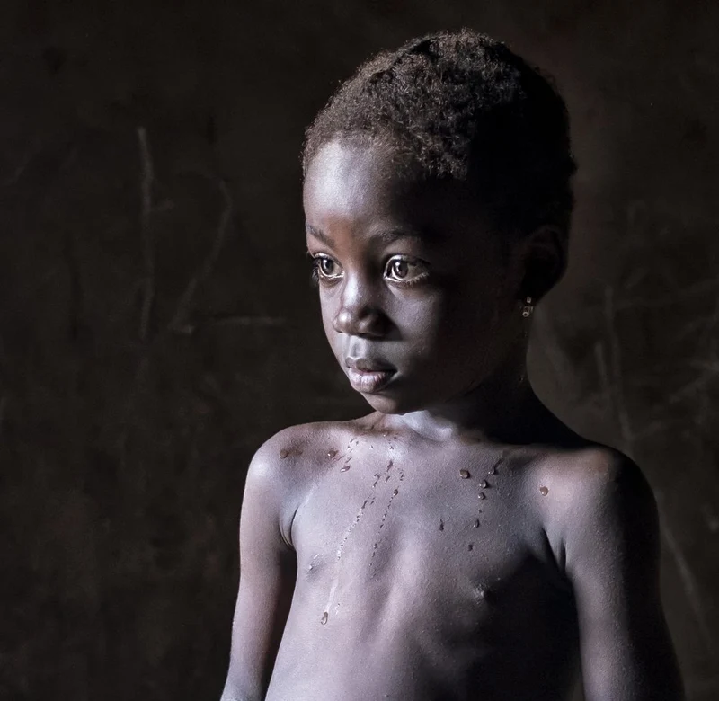 Pensive African Child