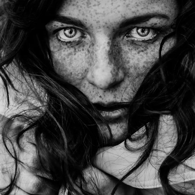 Portrait of freckles